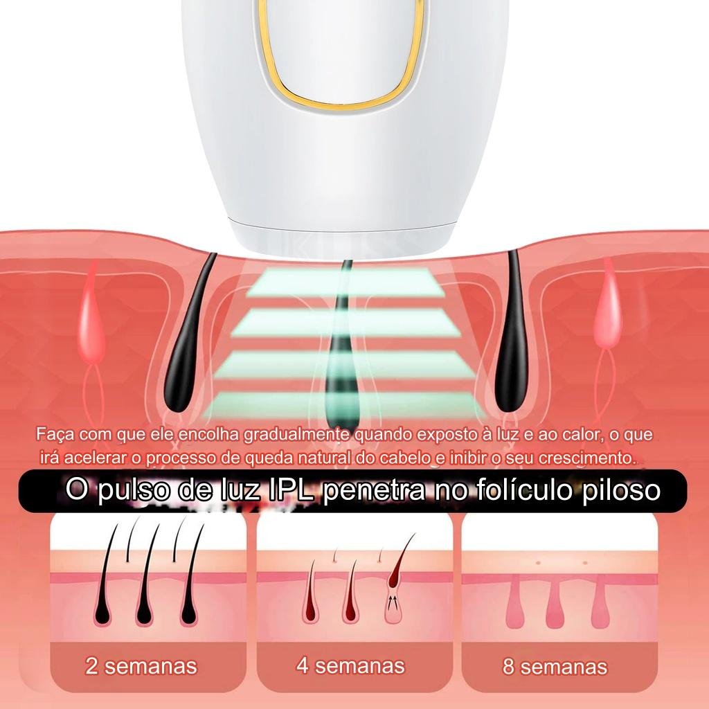 Depilador Laser 5 Níveis 999.999 Flashes